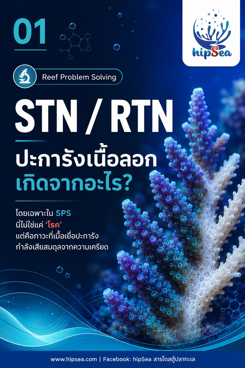 STN - RTN คืออะไร